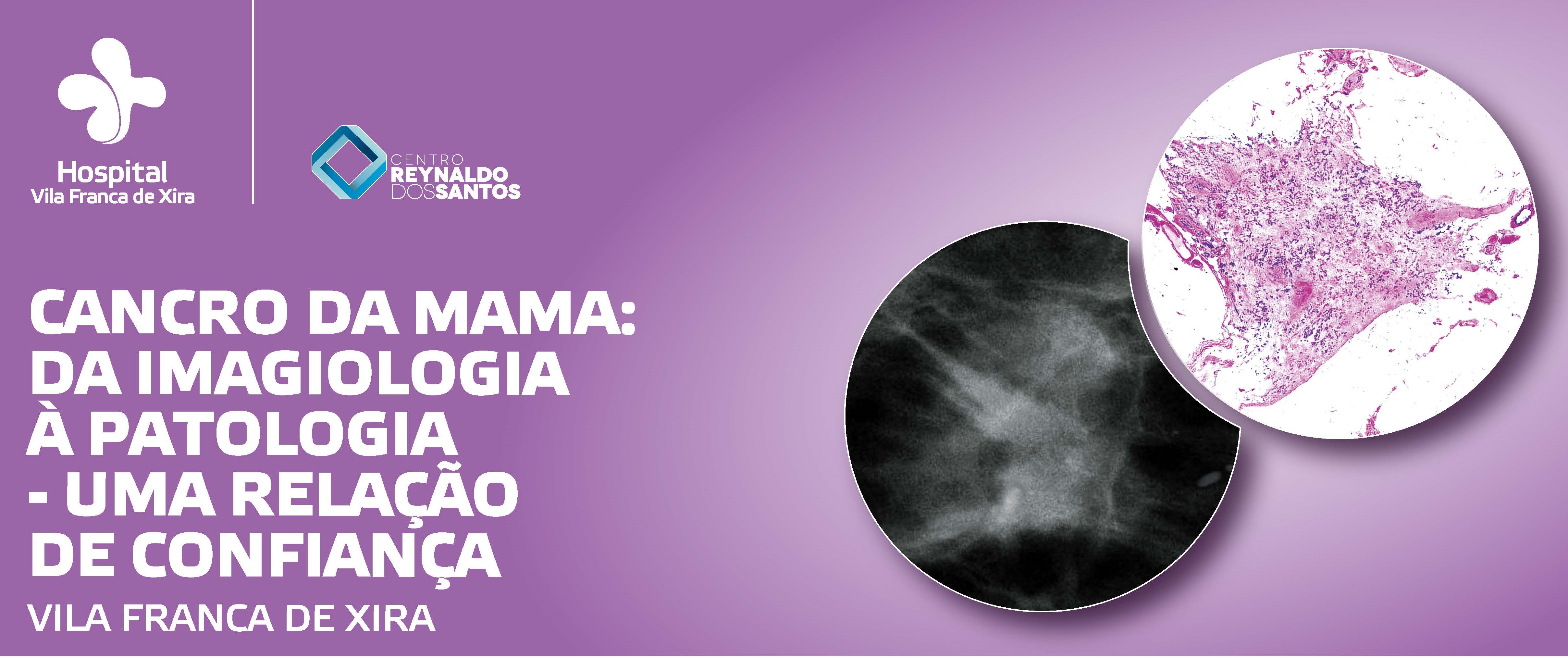 hospital-de-vila-franca-de-xira-Carcinoma da Mama: da imagiologia à anatomia patológica